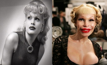 Amanda-Lepore-Before-and-After